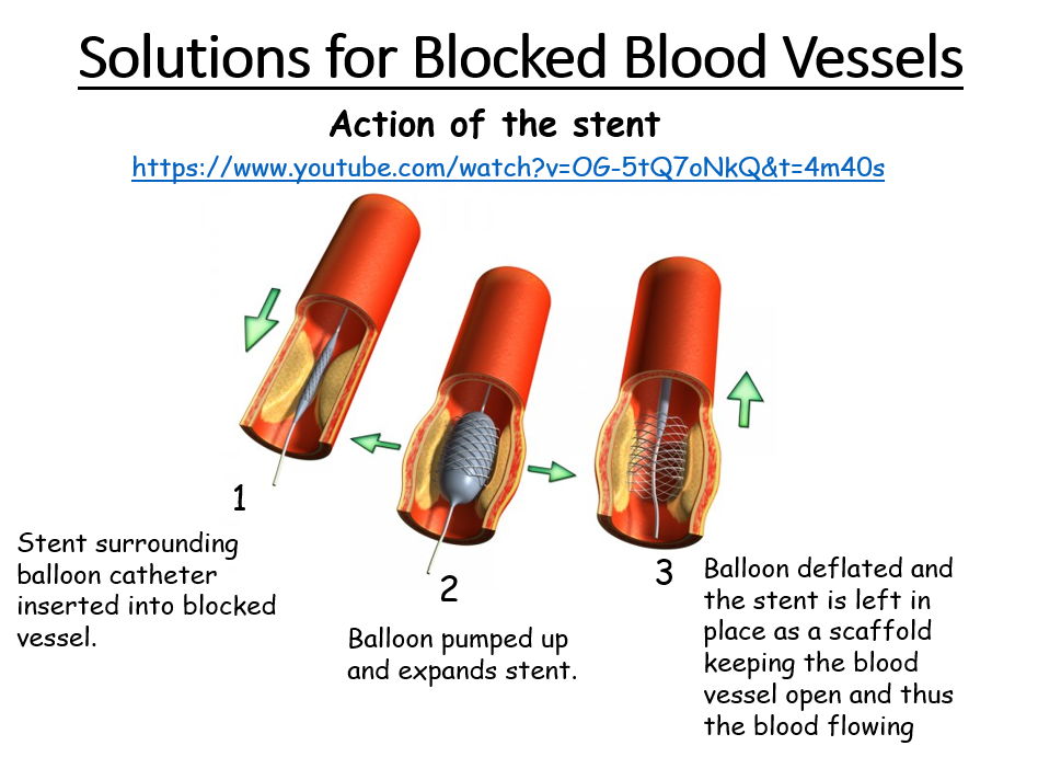 AQA GCSE Biology - B4 - Animal Transport Bundle