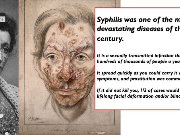 Did Paul Ehrlich change medicine - Simple GCSE lesson