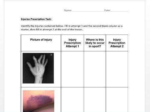 A-Level PE Injuries Activity Sheet