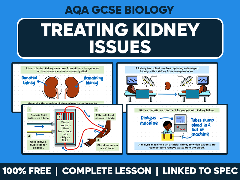 GCSE AQA Biology Complete Lesson - Treating Kidney Issues