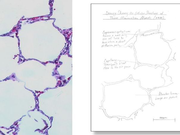 PAG 1.3: Using a Light Microscope to Examine Lung Tissue