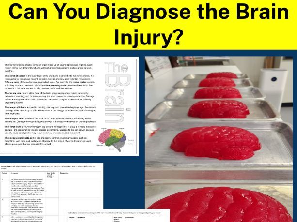 Brain damage: Patient case studies