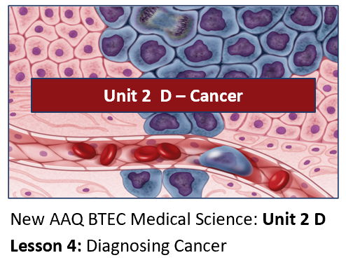 AAQ BTEC Medical Science Unit 2 D Cancer – Lesson 4: Diagnosing Cancer