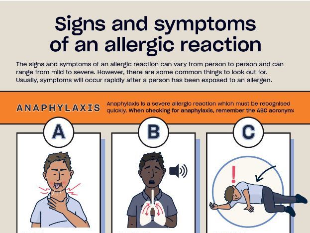 Allergy and Anaphylaxis Posters