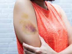 OCR A Level Law Non-fatal Offences Power Point and Worksheet