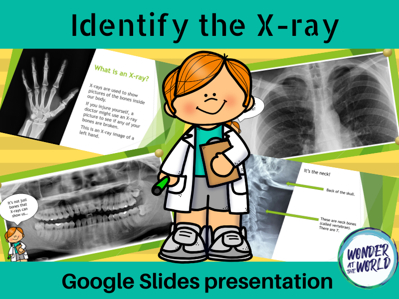 Identify the Xray Google Slides Teaching Resources