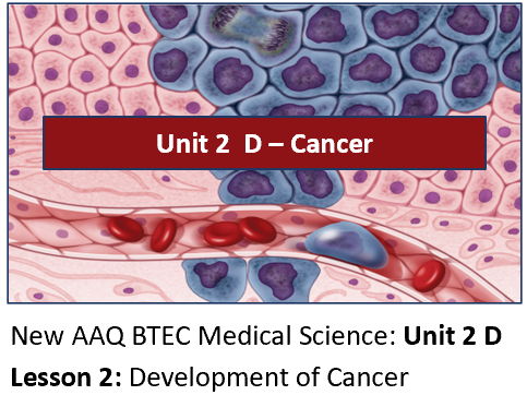 AAQ BTEC Medical Science Unit 2 D Cancer – Lesson 2: Development of Cancer