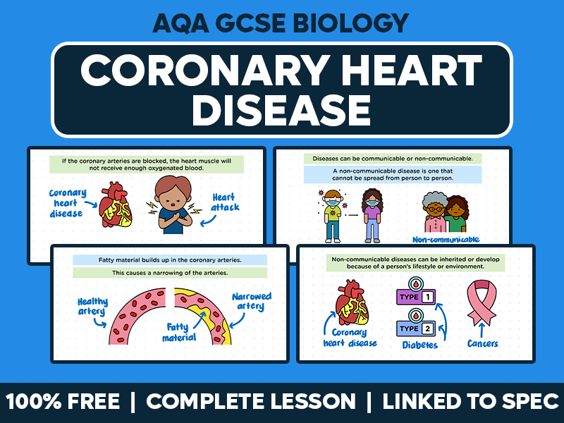 GCSE AQA Biology Complete Lesson - Coronary Heart Disease