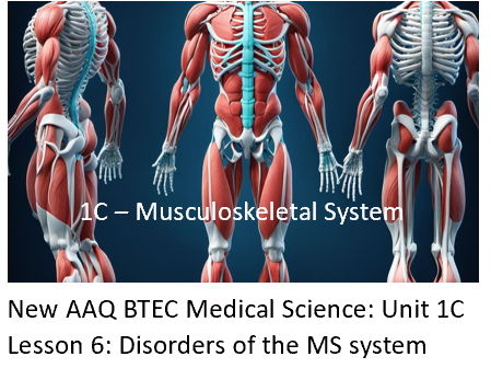 NEW: AAQ BTEC Medical Science Unit 1C Musculoskeletal System - Lesson 6: Disorders