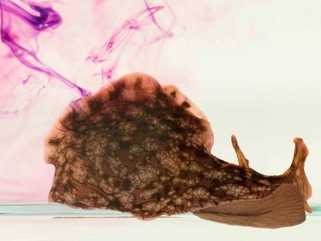 KS4 & KS5 biology: How are sea slugs helping us understand human health conditions?