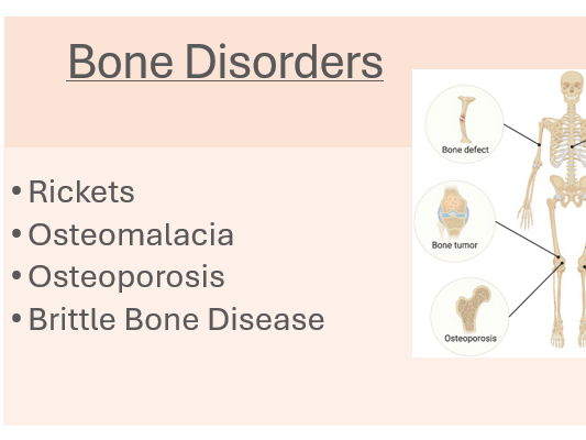 Bone disorders