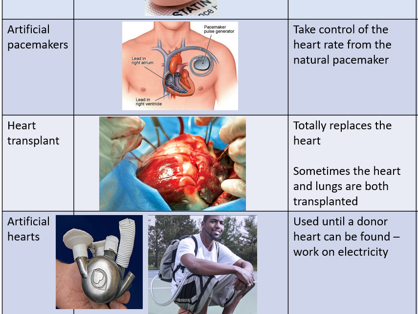 Trilogy, Organisation revision & RAG sheet