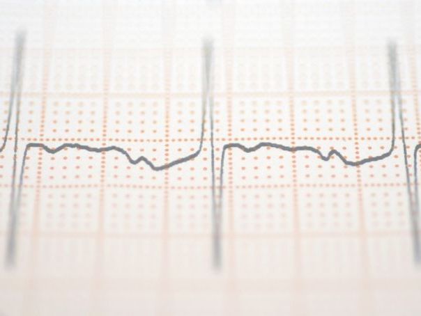 Edexcel A-Level PE: 1.2.1–1.2.9 Cardiovascular & Cardiorespiratory Pack