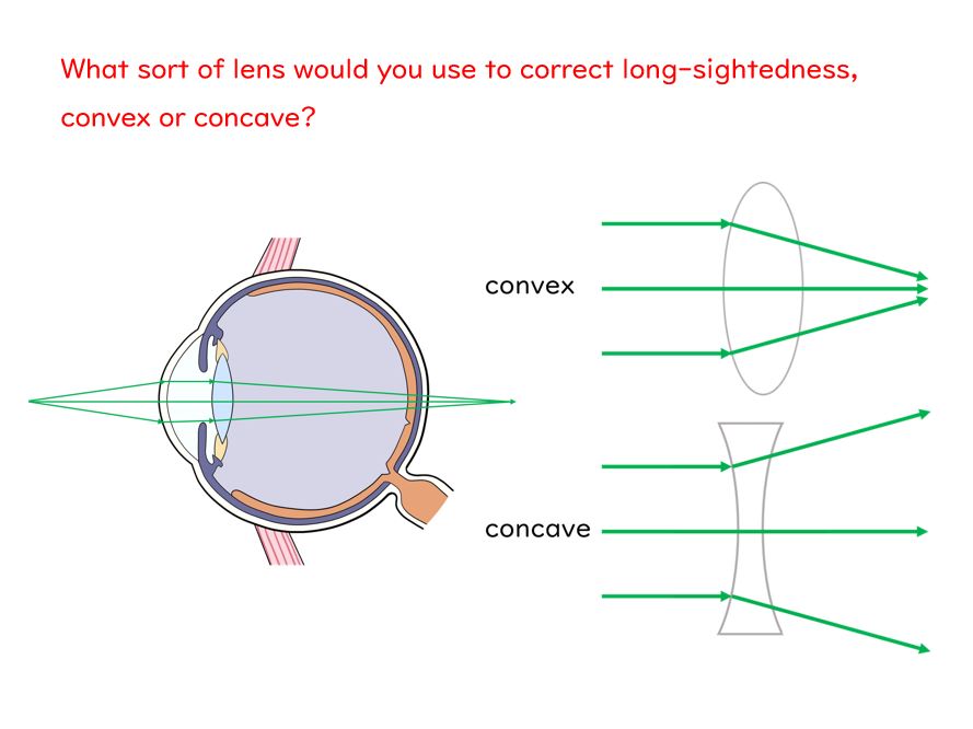 The Eye Slides and Worksheet (GCSE Biology AQA) Teaching Resources