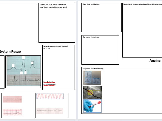 F091 Cardiovascular system Knowledge Organiser