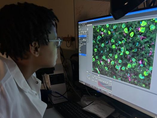 KS4 & KS5 biology: the links between adolescent brain development and schizophrenia