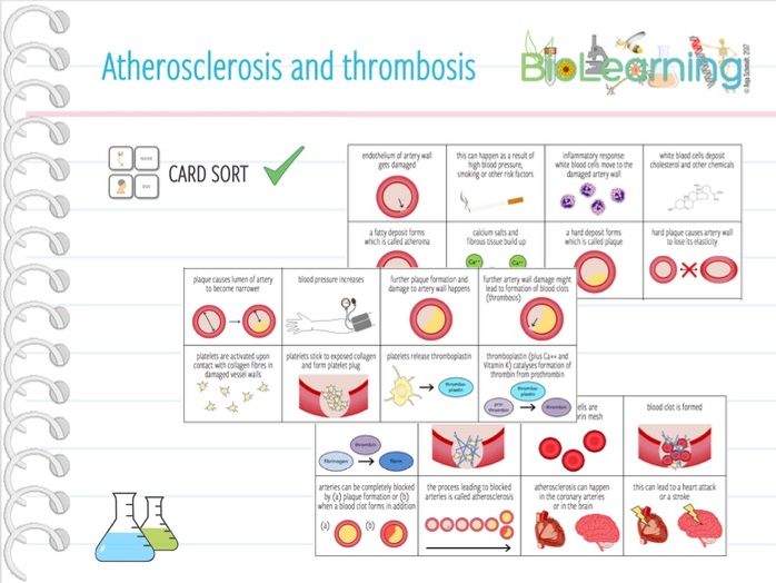 Atherosclerosis And Thrombosis Card Sort Ks5 Teaching Resources