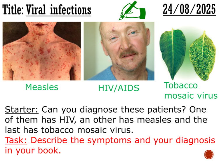 Viral infections - complete lesson (GCSE 1-9)