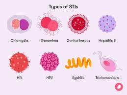 STIs - KS4