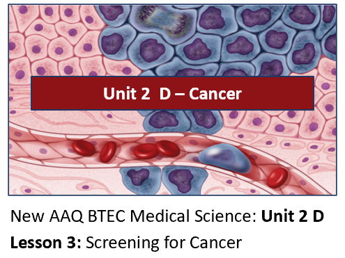 AAQ BTEC Medical Science Unit 2 D Cancer – Lesson 3: Screening for Cancer