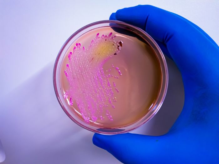 KS4 & KS5 biology: Can lactic acid fermentation disinfect manure?