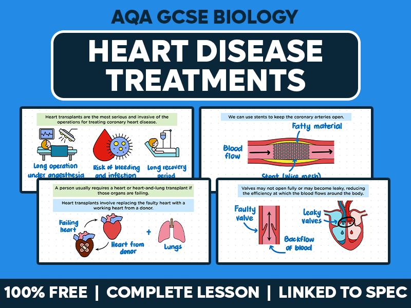 GCSE AQA Biology Complete Lesson - Heart Disease Treatments