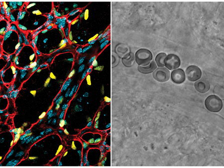 How do rare genetic disorders affect vitamin B12 metabolism and embryonic development?