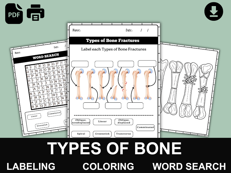 Types of Bone Fractures Diagram | Anatomy Labeling Worksheet | Coloring Page & Word Search | PDF Pri