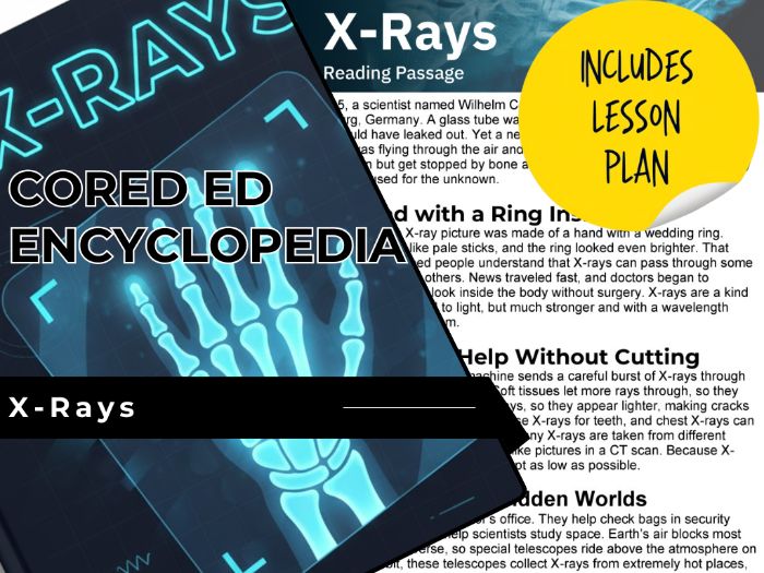 X-Rays Reading Comprehension Passage