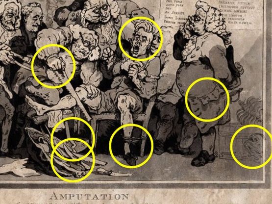 How was pain conquered? Anaesthetics GCSE lesson AQA Health Chloroform Ether