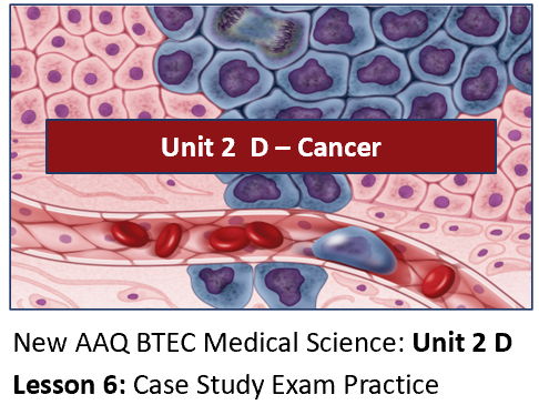 AAQ BTEC Medical Science Unit 2 D Cancer – Lesson 6: New Treatments & Case Study Exam Practice